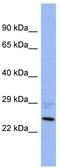 Protein Phosphatase, Mg2+/Mn2+ Dependent 1B antibody, TA344615, Origene, Western Blot image 