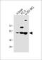 Adaptor Related Protein Complex 1 Subunit Mu 1 antibody, A10072-2, Boster Biological Technology, Western Blot image 