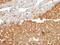 Farnesyl-Diphosphate Farnesyltransferase 1 antibody, GTX104091, GeneTex, Immunohistochemistry paraffin image 