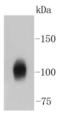 ATPase Na+/K+ Transporting Subunit Alpha 1 antibody, A00956-3, Boster Biological Technology, Western Blot image 