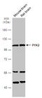Protein Tyrosine Kinase 2 Beta antibody, GTX130887, GeneTex, Western Blot image 