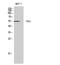 Checkpoint Kinase 1 antibody, STJ92266, St John