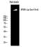 Inositol 1,4,5-Trisphosphate Receptor Type 1 antibody, PA5-40296, Invitrogen Antibodies, Western Blot image 
