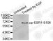 Estrogen Receptor 1 antibody, AP0347, ABclonal Technology, Western Blot image 