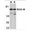 Interleukin 1 Receptor Associated Kinase 3 antibody, TA306061, Origene, Western Blot image 