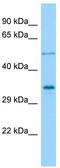 Vestigial Like Family Member 4 antibody, TA333864, Origene, Western Blot image 