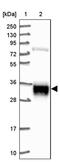 ADP Ribosylation Factor Like GTPase 6 Interacting Protein 4 antibody, PA5-62548, Invitrogen Antibodies, Western Blot image 