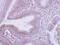 Coatomer Protein Complex Subunit Beta 1 antibody, PA5-29449, Invitrogen Antibodies, Immunohistochemistry frozen image 