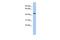 Programmed Cell Death 7 antibody, GTX44815, GeneTex, Western Blot image 