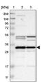 Methyltransferase Like 1 antibody, PA5-54280, Invitrogen Antibodies, Western Blot image 