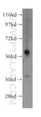 Glutamate Dehydrogenase 2 antibody, 14462-1-AP, Proteintech Group, Western Blot image 