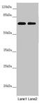 Dynein Cytoplasmic 1 Intermediate Chain 1 antibody, LS-C675676, Lifespan Biosciences, Western Blot image 