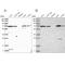 Arginyl Aminopeptidase antibody, NBP1-85897, Novus Biologicals, Western Blot image 