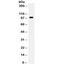 TNF Receptor Superfamily Member 11a antibody, R31815, NSJ Bioreagents, Western Blot image 