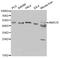 Alpha-Methylacyl-CoA Racemase antibody, LS-C331283, Lifespan Biosciences, Western Blot image 