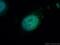 Cell Division Cycle 73 antibody, 12310-1-AP, Proteintech Group, Immunofluorescence image 