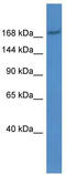 ABCC2 antibody, TA332361, Origene, Western Blot image 