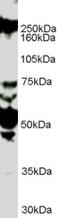 Roundabout Guidance Receptor 1 antibody, EB07058, Everest Biotech, Western Blot image 