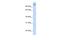 Poly(ADP-Ribose) Polymerase Family Member 9 antibody, A08508, Boster Biological Technology, Western Blot image 