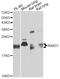 RAB31, Member RAS Oncogene Family antibody, A3667, ABclonal Technology, Western Blot image 