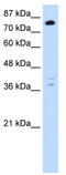 TSC22 Domain Family Member 2 antibody, TA343753, Origene, Western Blot image 