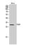 Fas Associated Via Death Domain antibody, A00237-1, Boster Biological Technology, Western Blot image 