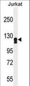 Adenylate Cyclase 2 antibody, LS-C156066, Lifespan Biosciences, Western Blot image 