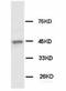 Keratin 18 antibody, LS-B14768, Lifespan Biosciences, Western Blot image 