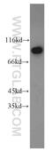 DExD-Box Helicase 50 antibody, 10358-1-AP, Proteintech Group, Western Blot image 