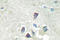 Activin A Receptor Type 1B antibody, LS-C176756, Lifespan Biosciences, Immunohistochemistry paraffin image 