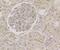 Core-Binding Factor Subunit Beta antibody, NBP2-76981, Novus Biologicals, Immunohistochemistry paraffin image 