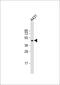 Keratin 14 antibody, 62-420, ProSci, Western Blot image 