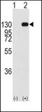 Fibroblast Growth Factor Receptor 1 antibody, PA5-14646, Invitrogen Antibodies, Western Blot image 