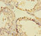 FA Complementation Group D2 antibody, A67350-100, Epigentek, Immunohistochemistry paraffin image 