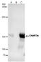 DNA Methyltransferase 3 Alpha antibody, GTX129126, GeneTex, Immunoprecipitation image 