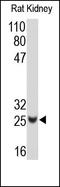 TIMP Metallopeptidase Inhibitor 2 antibody, 251897, Abbiotec, Western Blot image 
