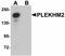 Pleckstrin Homology And RUN Domain Containing M2 antibody, orb94340, Biorbyt, Western Blot image 
