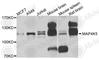 Mitogen-Activated Protein Kinase Kinase Kinase Kinase 5 antibody, A7962, ABclonal Technology, Western Blot image 