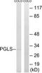 6-Phosphogluconolactonase antibody, TA315287, Origene, Western Blot image 