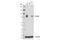 Forkhead Box O3 antibody, 99199S, Cell Signaling Technology, Western Blot image 