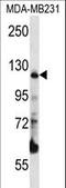 Pitrilysin Metallopeptidase 1 antibody, LS-C163742, Lifespan Biosciences, Western Blot image 