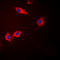 Casein Kinase 1 Alpha 1 antibody, LS-C354242, Lifespan Biosciences, Immunofluorescence image 