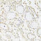 Aladin WD Repeat Nucleoporin antibody, 22-213, ProSci, Immunofluorescence image 