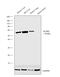 Aldehyde Dehydrogenase 2 Family Member antibody, PA5-29717, Invitrogen Antibodies, Western Blot image 