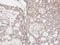 Glycerate Kinase antibody, GTX107807, GeneTex, Immunohistochemistry paraffin image 