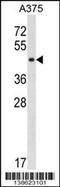 SGT1 Homolog, MIS12 Kinetochore Complex Assembly Cochaperone antibody, 60-101, ProSci, Western Blot image 