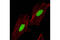 ATP-dependent DNA helicase Q1 antibody, 4839S, Cell Signaling Technology, Immunocytochemistry image 