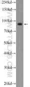 Karyopherin Subunit Beta 1 antibody, 10077-1-AP, Proteintech Group, Western Blot image 