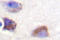 Protein Tyrosine Kinase 2 antibody, LS-C176513, Lifespan Biosciences, Immunohistochemistry paraffin image 
