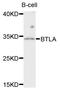 B And T Lymphocyte Associated antibody, LS-C748496, Lifespan Biosciences, Western Blot image 